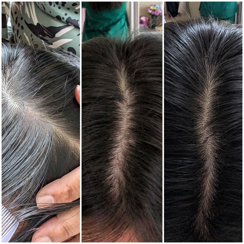 Customer review photo showing scalp regrowth over time