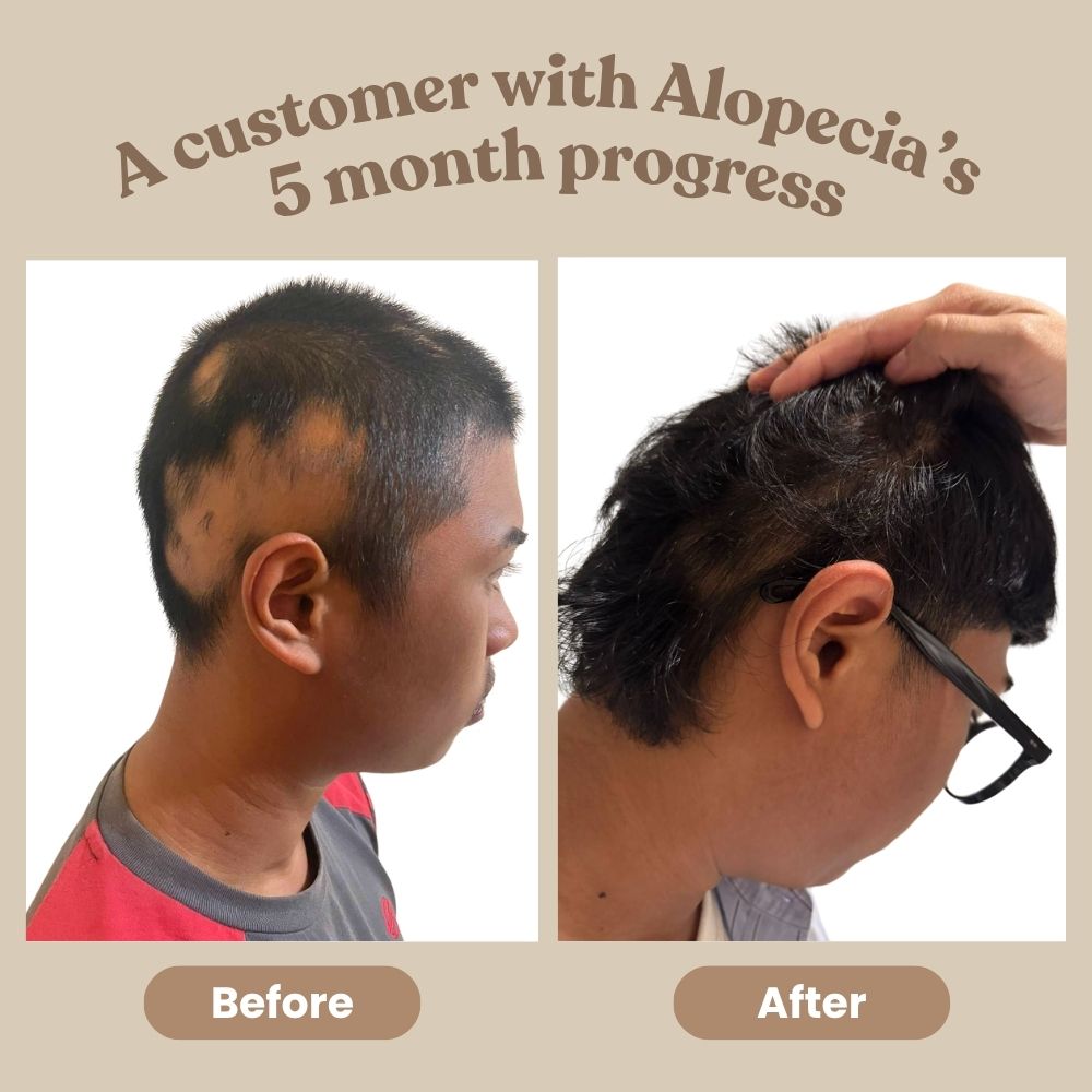 Anti Hair Loss Ginger Shampoo
