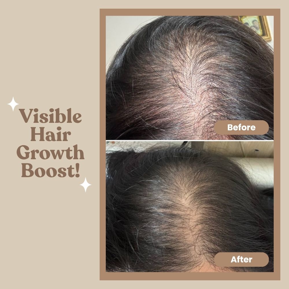 Anti Hair Loss Ginger Shampoo