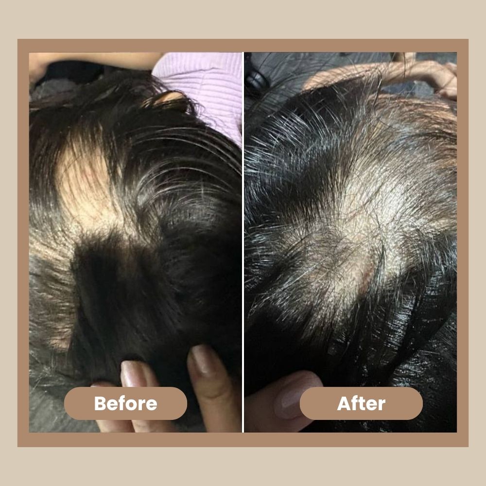 Anti Hair Loss Ginger Shampoo