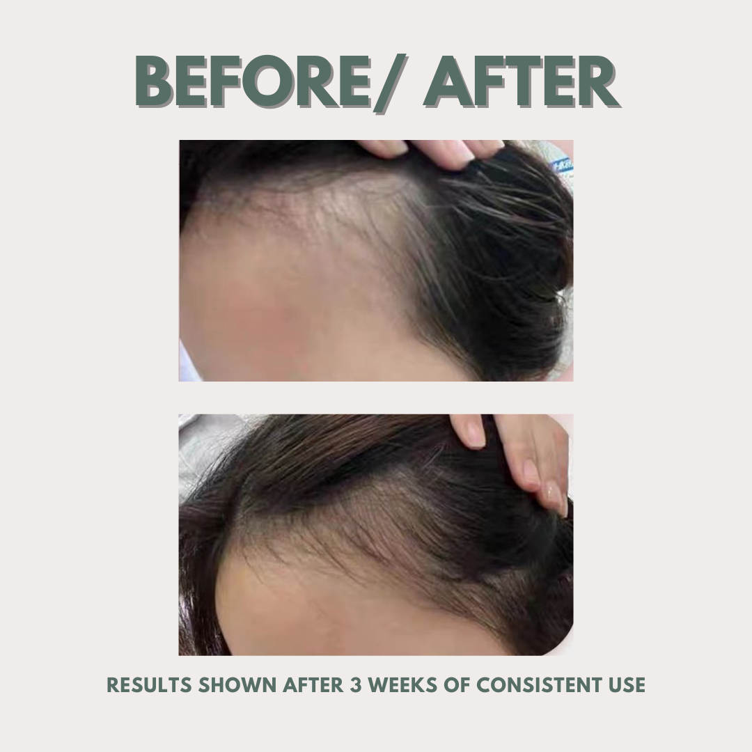 5x Roots Revival Herbal Hair Growth Essence