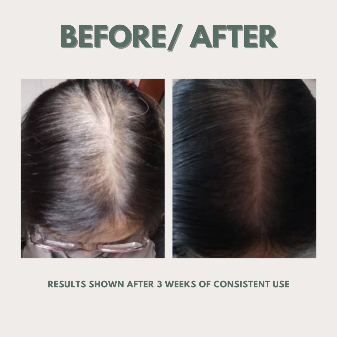 5x Roots Revival Herbal Hair Growth Essence
